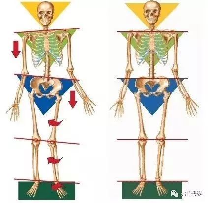 骨盆变形危害大,产后妈妈必须注意这7个危险信号