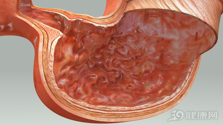 人人都抗拒,却是胃癌的"照妖镜"!你愿意做吗?