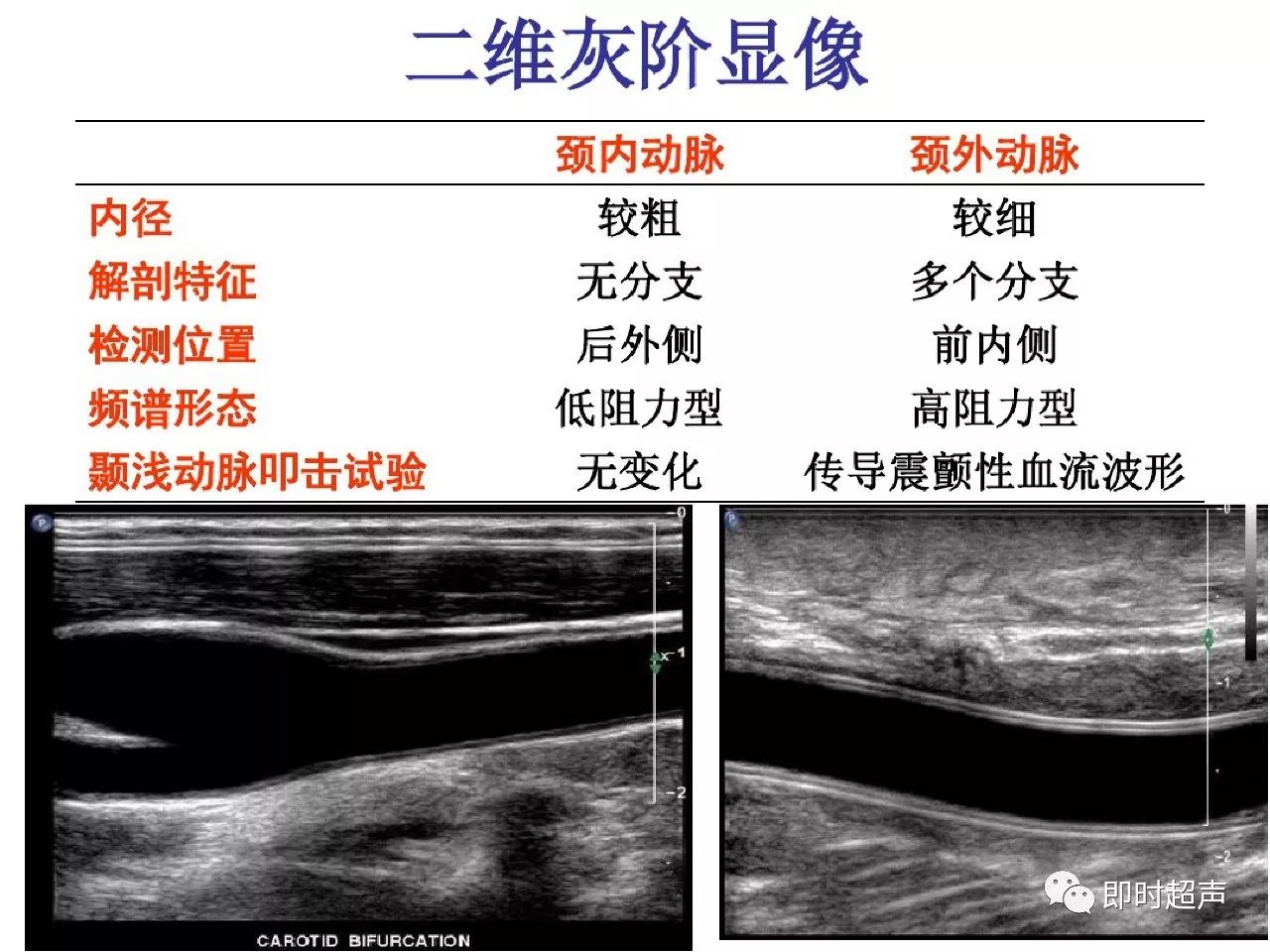 颈部血管超声正常解剖及常见病的超声诊断标准