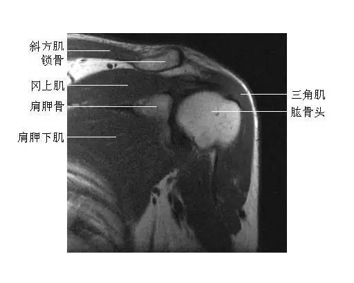 肩关节冠状面(4)