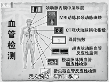 动脉硬化后要做哪些检查7,腹型肥胖,缺乏运动的人群.