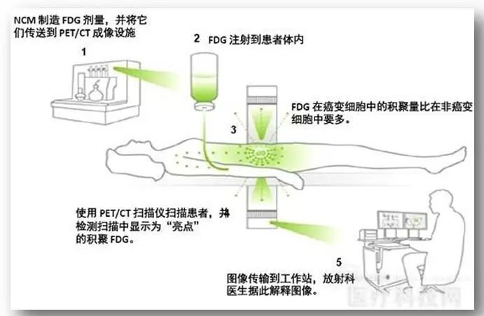 汉中市中心医院petct