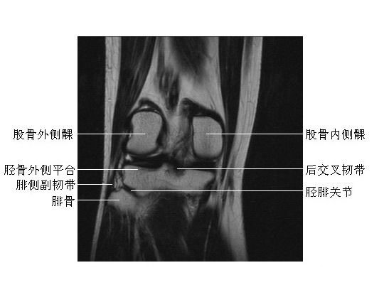 膝关节冠状面(1)