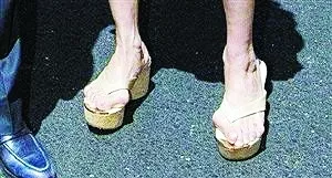 女明星为了穿高跟鞋太拼了,脚趾头变形了还不能放弃.