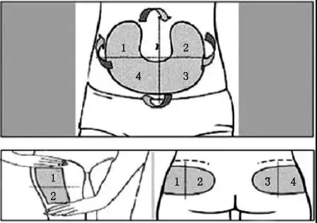 注射部位轮换方案:数字表示可供转换的不同区域