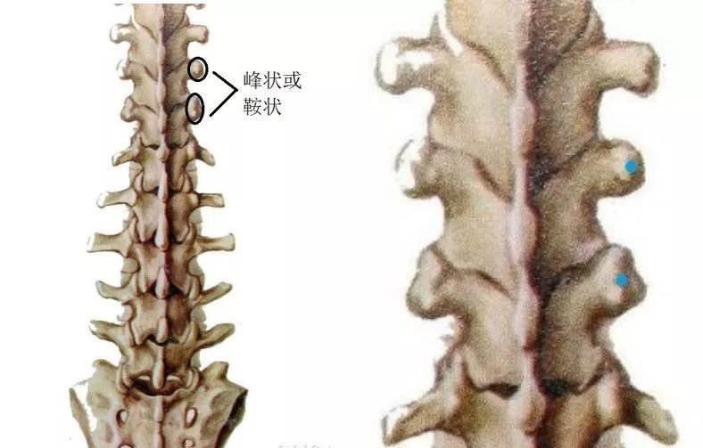 【收藏】最全胸腰椎椎弓根置钉技术汇总