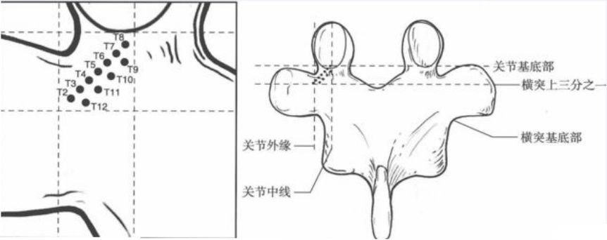 胸椎椎弓根钉置入----难点 脊柱外科手术图谱-----胸椎dick进针定位法