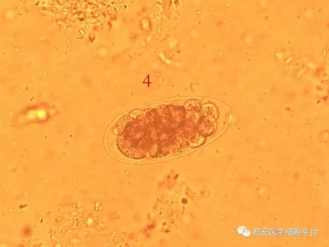 2 受精蛔虫卵:呈宽椭圆形,大小约为(45～75)μm(35～50)μm,棕黄色