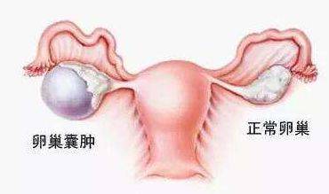 人口增生_疤痕增生图片