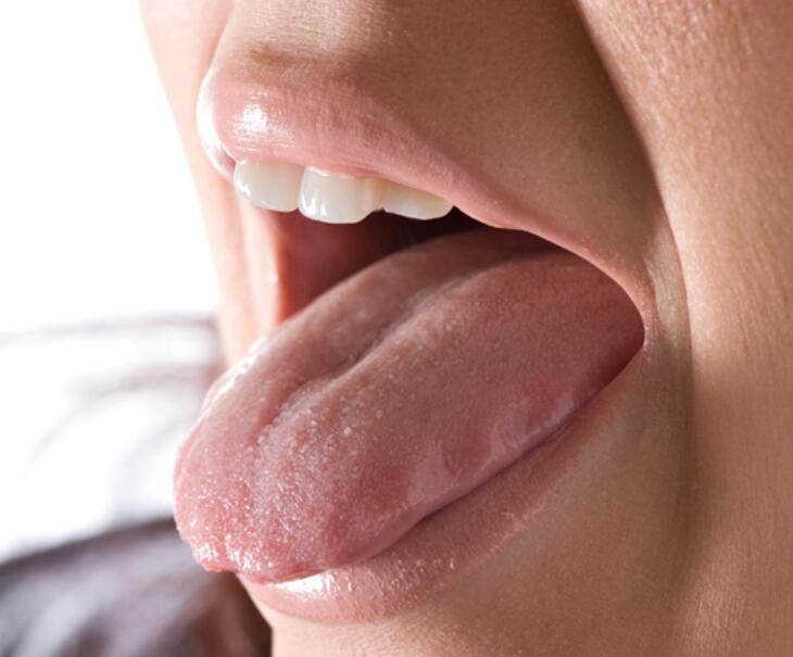 千万不能忽视,因为有可能是舌癌的早期症状