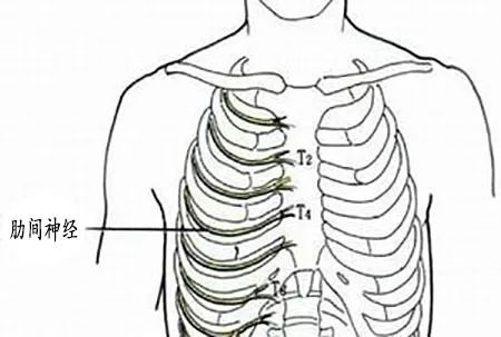 肋间神经痛的推拿疗法