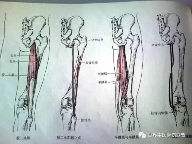 ②前屈拮抗肌(后伸肌:臀大肌,股二头肌长头,半腱肌,半膜肌,大收机后