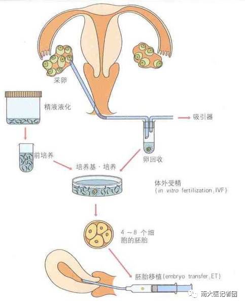 辅助生殖流程