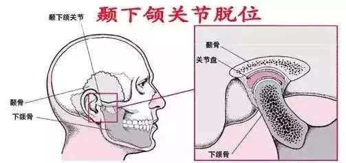 牙齿关节错位怎么办