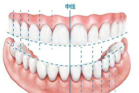 尖牙长在牙龈上怎么办
