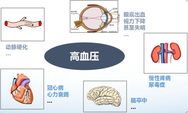 出现这些症状时,就说明你可能是血压高了,要尽快就诊.