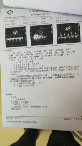 包头人帮帮她!6个月大女婴查出心脏病,几个月前爸爸离世