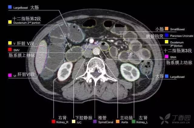 最实用的上腹部 CT 图谱,看过的医生都收藏
