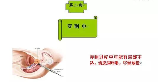 0 ng/ml(3)b超发现前列腺低回声结节或mri(核磁共振成像)发现异常信号