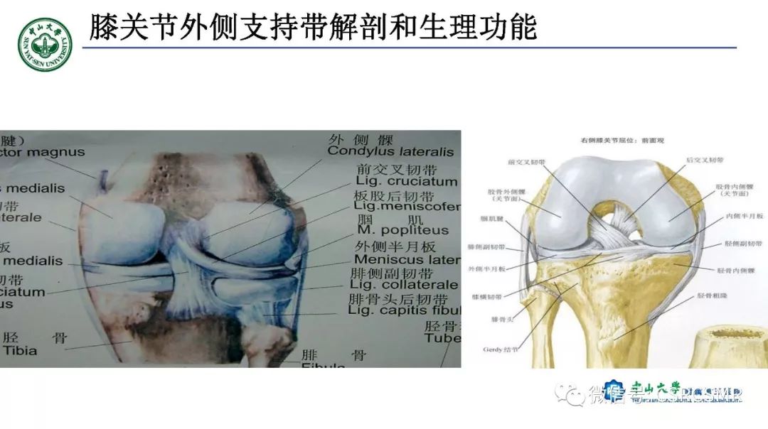 膝关节后外侧角区影像解剖及损伤后影像学诊断