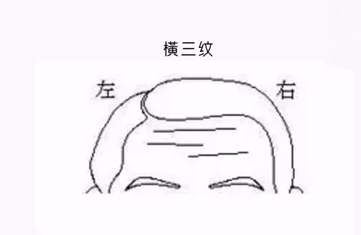 悬针纹