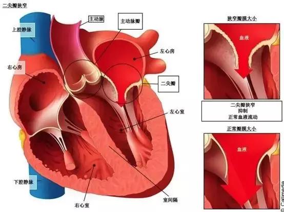 心脏瓣膜疾病你需要知道的