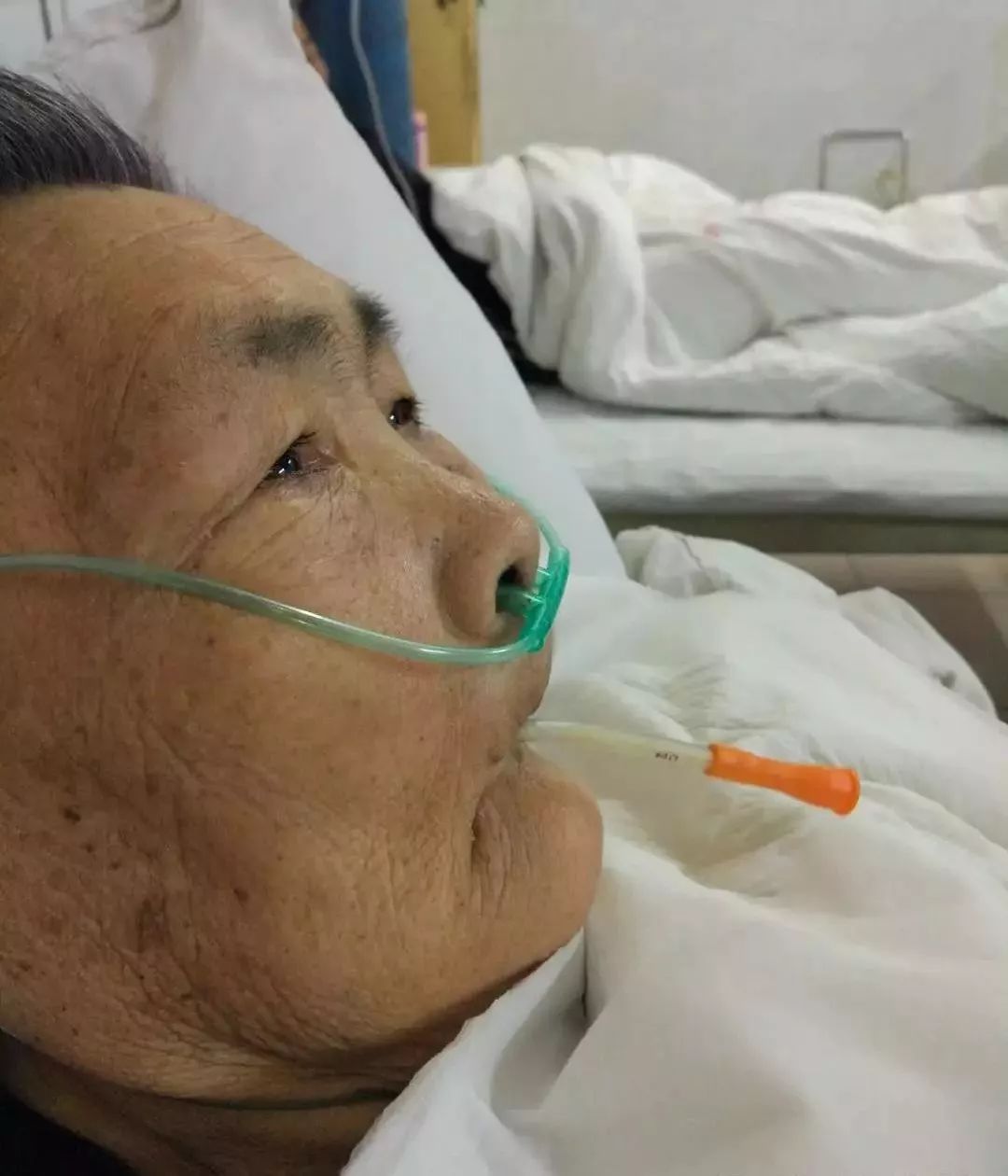 博罗县人民医院首例床旁徒手盲插鼻空肠置管术成功开展