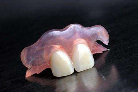 ①活动义齿:这是一种由基托,卡环,烤瓷牙组成的义齿,是依靠牙床支持