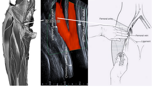 这块区域,存在通过股静脉穿透