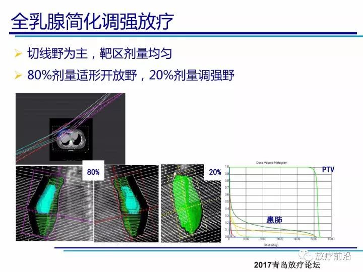 课件| 王淑莲:乳腺癌保乳术后放疗靶区勾画