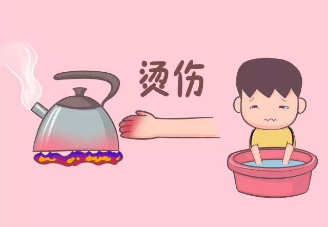 烫伤:用冷水冲,冰块敷