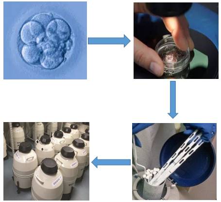 冻胚最好在35岁前进行?成功率竟然超过新鲜胚胎?