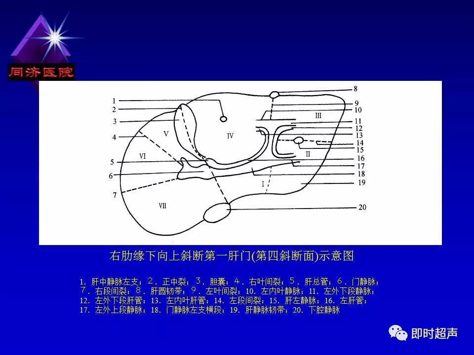 正常肝脏的超声解剖及局限病变的超声诊断