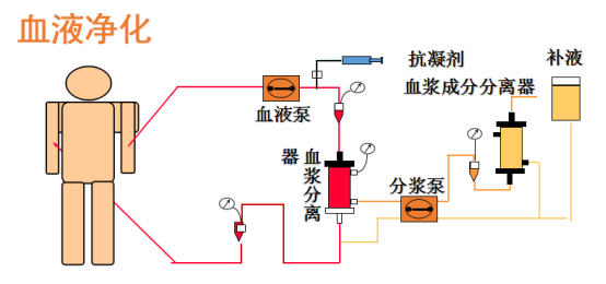 血液净化技术的基本原理_血液净化技术的互补性   血液净化技术在原有技术基础上不断发展和(3)