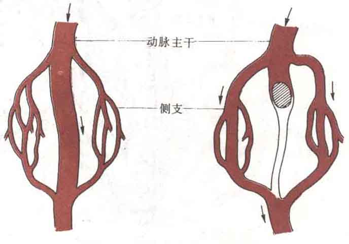 一旦血管发生堵塞,侧枝循环还可以保持一定的供血.