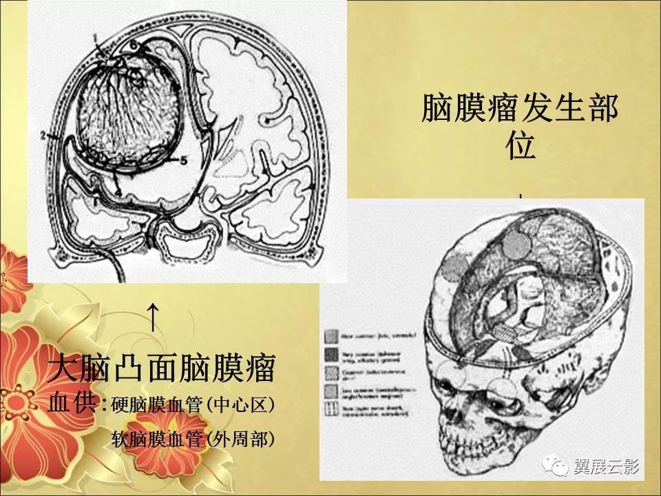 头部ct解剖及常见疾病的影像诊断