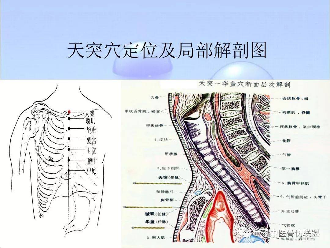 穴位名称: 天突 [经穴] 【定位】:在颈部,当前正中线上,胸骨上窝中央