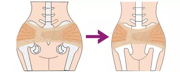 90%的女性骨盆都有变形,快快矫正,彻底远离妇科疾病!