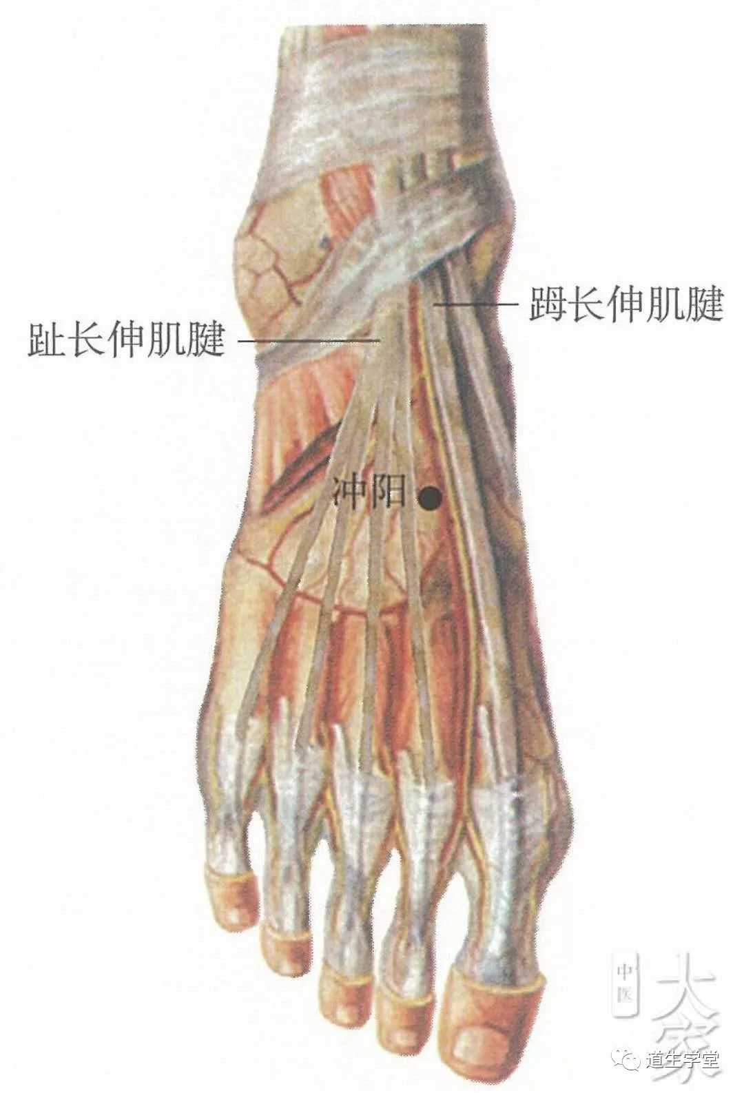 冲阳穴位于人体的足背最高处,当拇长伸肌腱和趾长伸肌腱之间,足背