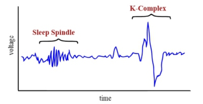 成人化转变,会出现"stage two spindle activity"(第二阶段睡眠纺锤波