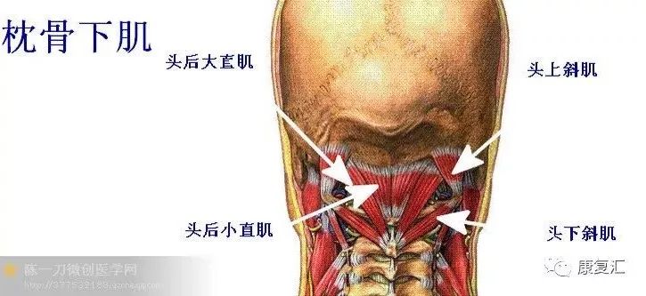 由枕骨下肌形成的三角叫做枕骨下三角,它的肌肉经常与颈后部其他肌肉