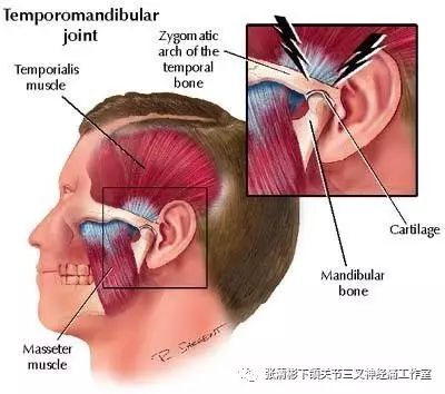 颞下颌关节紊乱病分类简介