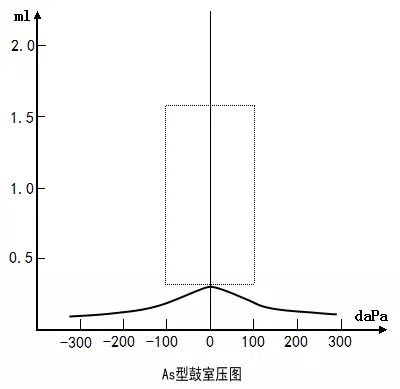 验配专栏分析中耳病变必备认识各种鼓室图