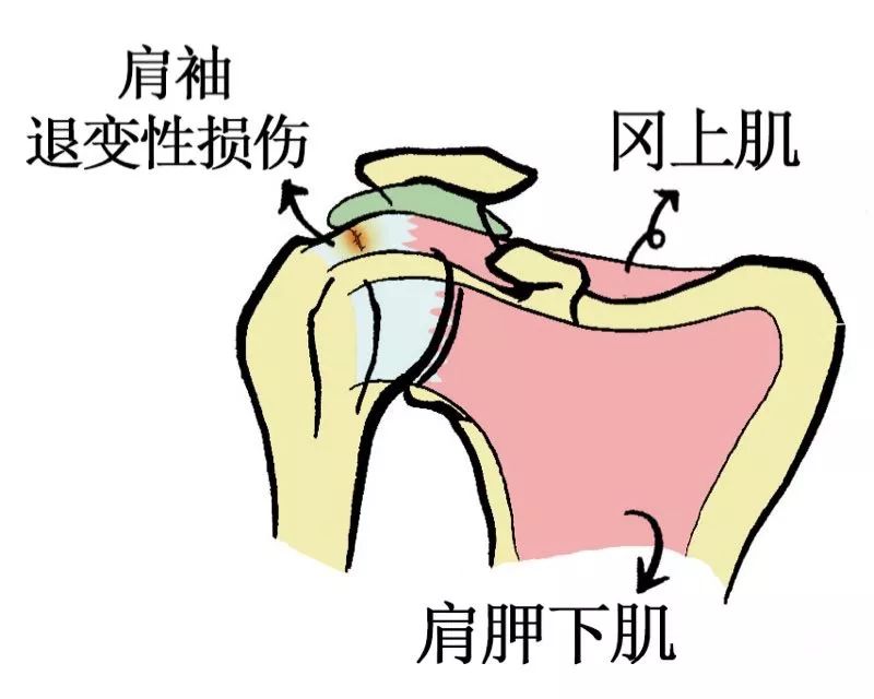 外旋作用—冈下肌,小圆肌;内旋作用—肩胛下肌,形成力偶,稳定肩关节1.