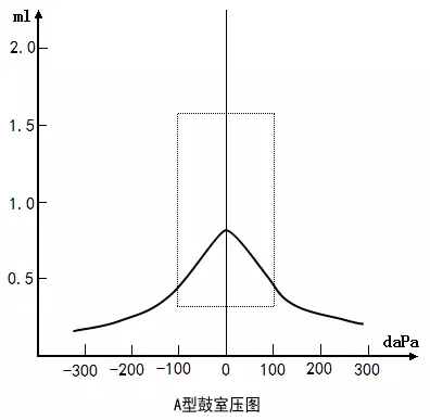 【验配专栏】分析中耳病变必备--认识各种鼓室图