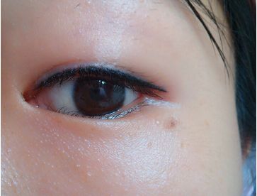 单眼皮 单眼皮因为睫毛根部被眼皮遮盖住,所以做美瞳线的效果就不