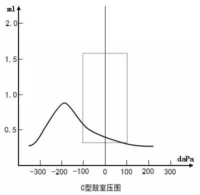 c型(负压型) 鼓室图形态正常,但偏负压超过-100dapa,峰值幅度在