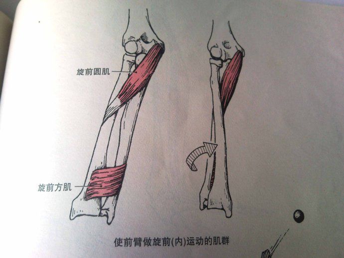 上背部多裂肌过弱 重点改善动作:健身球基本背伸展 五,手臂的过度旋前