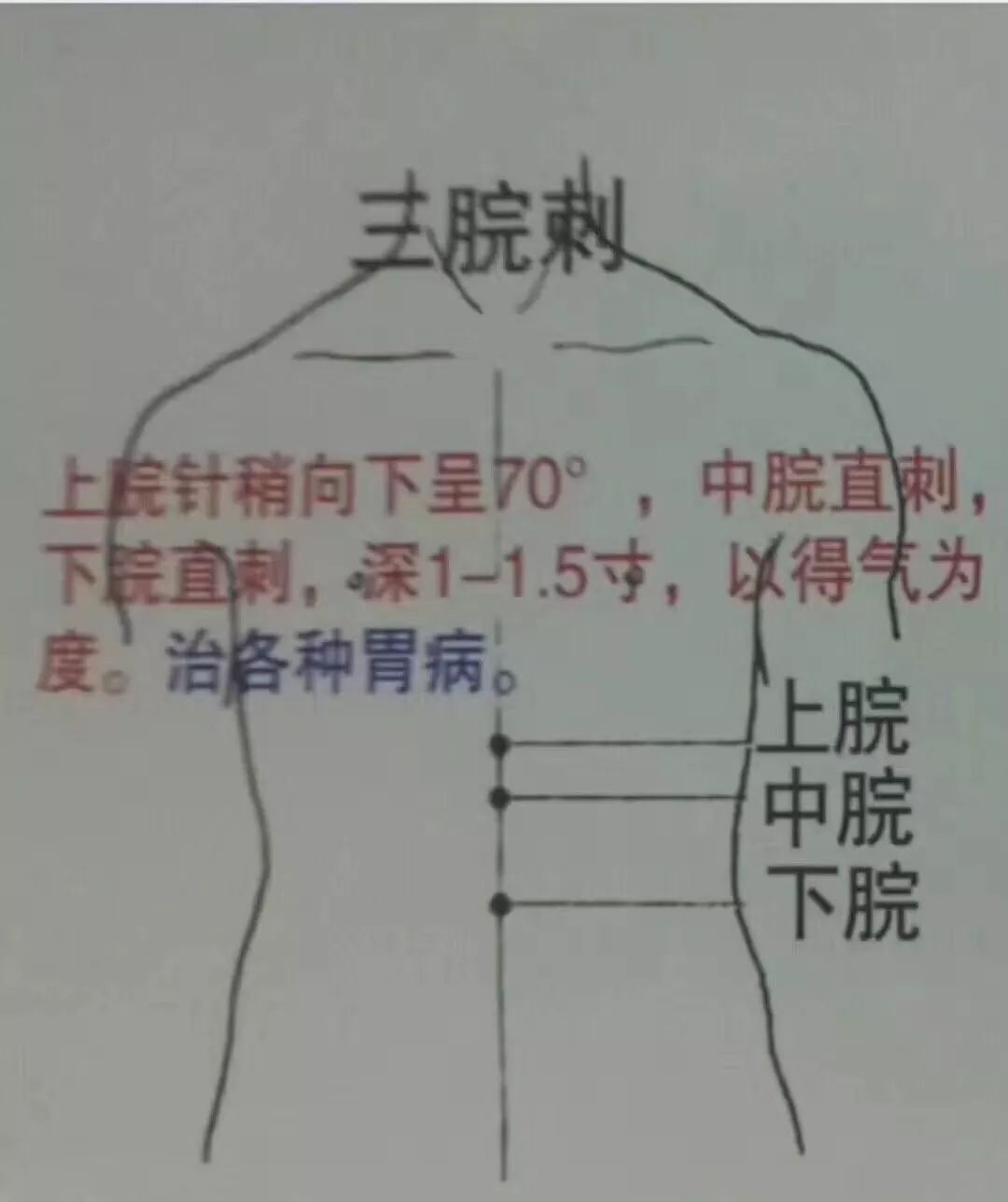 中医针灸各种刺法图文讲解