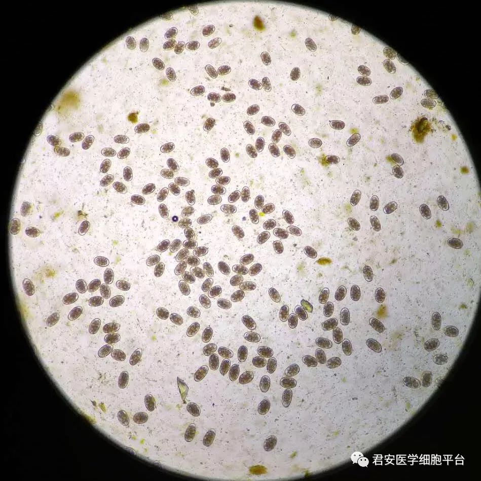 第一张 钩虫的病原学诊断 定性检查:从粪便中检出钩虫卵或培养出钩蚴